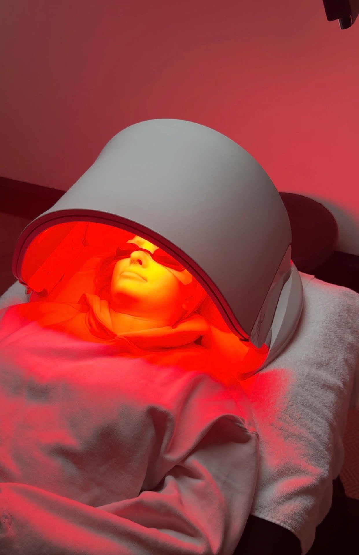 Dermaluxe treatment result at Faded Skin®